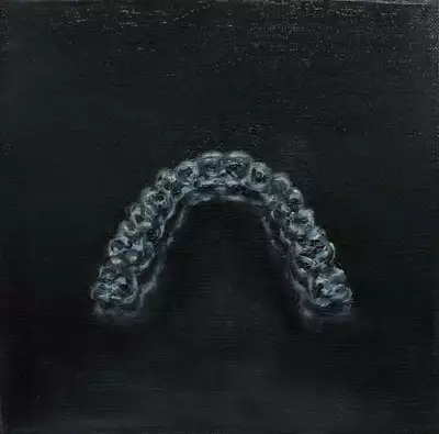 aligner invisalign dentistry black